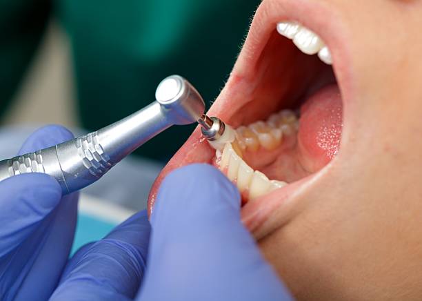 Best Tooth Extraction  in Bennettsville, SC